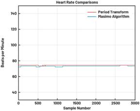 動態離散周期變換技術突破：無ECG參考的生理信號精準解析