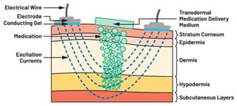  圖5.人體皮膚分層橫截面以及TMD和生物阻抗測(cè)量  考慮到生物阻抗分析的無創(chuàng)性，使用兩個(gè)金屬電極代表電氣傳感器，連接模擬前端(AFE)電路和患者皮膚。這個(gè)金屬與非金屬的接觸點(diǎn)是構(gòu)成整個(gè)電路的另一個(gè)關(guān)鍵部分，連接了AFE和人體電氣模型。電荷載體（電極中的電子和人體內(nèi)的離子）之間的相互作用可能對(duì)這些傳感器的性能產(chǎn)生重大影響，需要根據(jù)每種應(yīng)用進(jìn)行具體考慮。首先，金屬與離子溶液接觸的相互作用導(dǎo)致金屬表面附近溶液中離子濃度的局部變化。這種現(xiàn)象會(huì)改變電極下方區(qū)域的電荷中性，導(dǎo)致金屬周圍的電解質(zhì)電位與溶液其余部分不同，從而在金屬和電解質(zhì)主體之間產(chǎn)生一個(gè)電位差，即常說的“半電池電位”。其次，注入電流的直流分量會(huì)導(dǎo)致電極極化。  表1.各種電極類型和相應(yīng)的半電池電位  金屬及反應(yīng)  半電池電位(V)  Al → Al3+ + 3e- Al → Al3+ + 3e-  –1.706 –1.706  Ni → Ni2+ + 2e- Ni → Ni2+ + 2e-  –0.230 -0.230  H2 → 2H+ + 2e- H2 → 2H+ + 2e-  0.000 (by definition) 0.000（根據(jù)定義）  Ag + Cl- → AgCl + e- Ag + Cl- → AgCl + e-  +0.223 +0.223  Ag → Ag+ + e- Ag → Ag+ + e-  +0.799 +0.799  Au → Au+ + e- Au → Au+ + e-  +1.680 +1.680  這是一種不良現(xiàn)象，往往導(dǎo)致電極性能下降。這些考量表明，電極也需要定義適當(dāng)?shù)碾姎饽Ｐ停▍⒁妶D6）。我們可以將干電極表示為具有三個(gè)串聯(lián)元件的電路：一個(gè)用于模擬半電池電位(EHC)的直流電源；一個(gè)用于模擬金屬和非金屬（人體）之間接觸的RC并聯(lián)電池(Rd||Cd)；以及一個(gè)用于模擬電極金屬的電阻Rs。